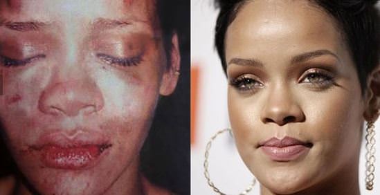 Amber Heard'den Johnny Depp hakkında korkunç iddia