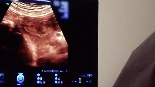 Kylie Jenner'ın anne olma yolundaki özel anları