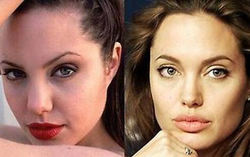 Estetikten önce daha güzellermiş...