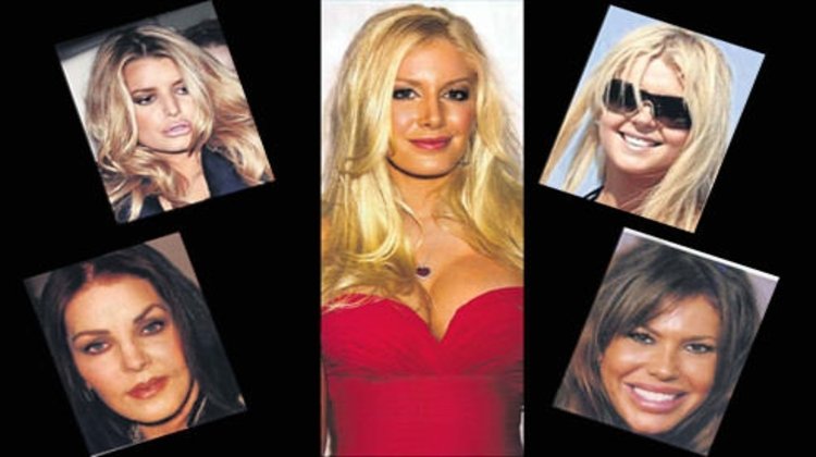 Estetik herkeze yaramıyor!