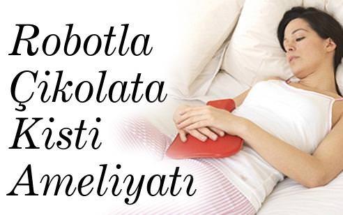 Robotla çikolata kisti ameliyatı