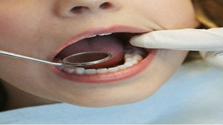 Ağızdan nefes almak diş sorunlarına neden oluyor!