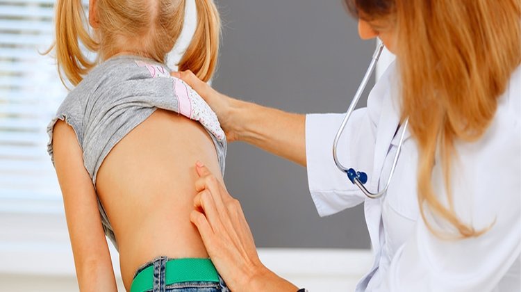 Çocuğunuzun skolyoz olup olmadığını nasıl anlarsınız?