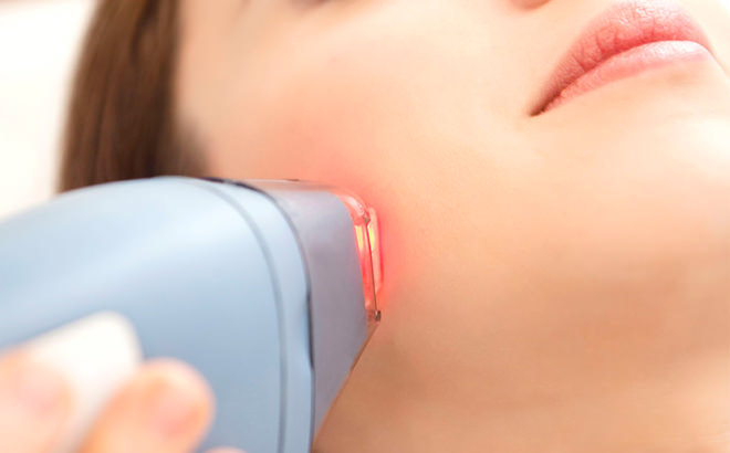 Lazer epilasyon için en küçük yaş sınırı ne olmalıdır?