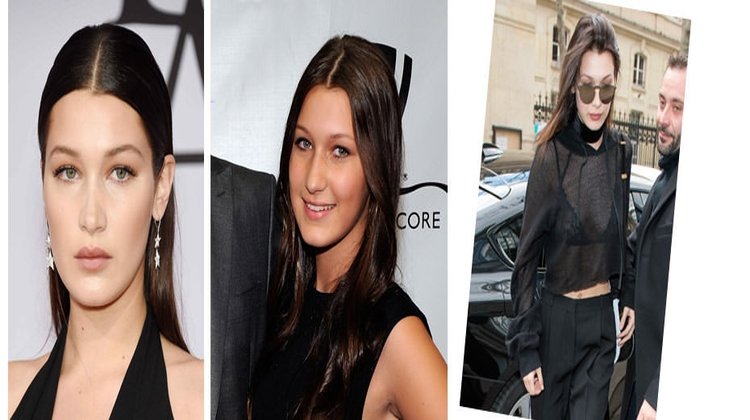 Bella Hadid`in estetiksiz hali şaşırttı