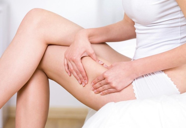 Kadınların en büyük sorunu: Ödem