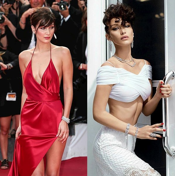 "Yüzümde hiç estetik yok!"