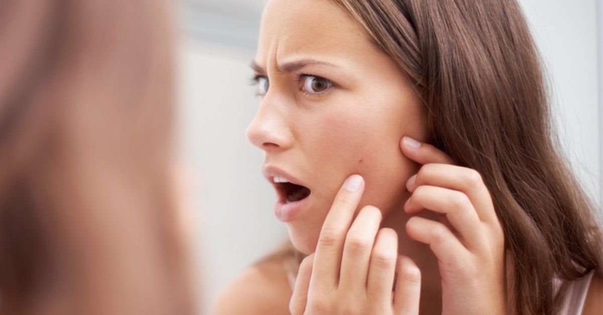 Sivilceli ciltlere makyaj önerisi